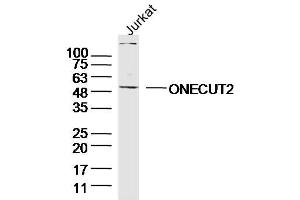 Jurkay lysates probed with ONECUT2 Polyclonal Antibody, Unconjugated  at 1:300 overnight at 4˚C. (ONECUT2 antibody  (AA 401-504))