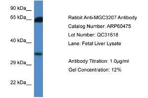 Western Blotting (WB) image for anti-Methylthioribose-1-Phosphate Isomerase 1 (Mri1) (N-Term) antibody (ABIN2788459) (MRI1 antibody  (N-Term))