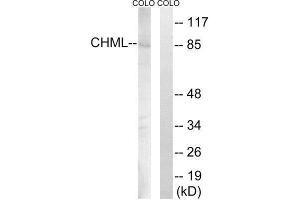 Western Blotting (WB) image for anti-Choroideremia-Like (Rab Escort Protein 2) (CHML) (Internal Region) antibody (ABIN1851923) (CHML antibody  (Internal Region))