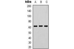 Western blot analysis of GTF2H1 expression in Hela (A), Jurkat (B), PC3 (C) whole cell lysates. (GTF2H1 antibody  (N-Term))