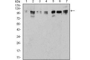 Western Blotting (WB) image for anti-Unc-51 Like Kinase 2 (ULK2) (AA 1-155) antibody (ABIN5882566) (ULK2 antibody  (AA 1-155))