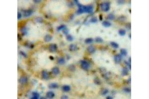 IHC-P analysis of Kidney tissue, with DAB staining. (LDHB antibody  (AA 1-334))