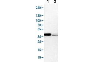 Western blot analysis of Lane 1: NIH-3T3 cell lysate (Mouse embryonic fibroblast cells), Lane 2: NBT-II cell lysate (Rat Wistar bladder tumour cells) with HNRNPA2B1 polyclonal antibody .