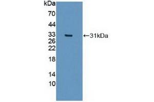 Detection of Recombinant IREB2, Human using Polyclonal Antibody to Iron Responsive Element Binding Protein 2 (IREB2) (IREB2 antibody  (AA 39-281))