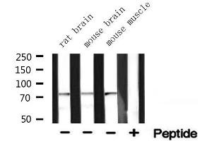 Western blot analysis of extracts of various tissue ,using ACSA antibody (ACSS2 antibody  (N-Term))