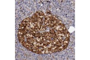 Immunohistochemical staining of human pancreas with STX3 polyclonal antibody  shows strong cytoplasmic positivity in islet cells at 1:200-1:500 dilution.