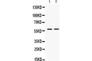 Observed bind size: 60KD (MMP8 antibody  (N-Term))