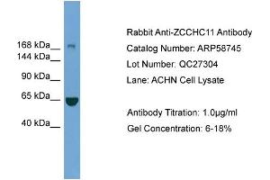 WB Suggested Anti-ZCCHC11  Antibody Titration: 0. (ZCCHC11 antibody  (Middle Region))