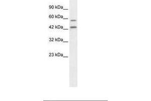 Image no. 2 for anti-Autophagy related 4B Cysteine Peptidase (ATG4B) (C-Term) antibody (ABIN6735868) (ATG4B antibody  (C-Term))