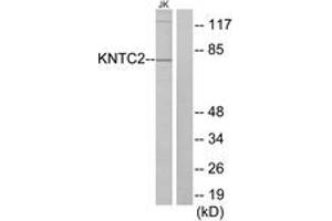 Western blot analysis of extracts from Jurkat cells, using KNTC2 Antibody. (NDC80 antibody  (AA 351-400))