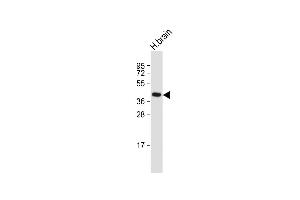 Anti-GFRAL Antibody (C-term) at 1:1000 dilution + Human brain whole cell lysate Lysates/proteins at 20 μg per lane. (GFRAL antibody  (C-Term))