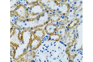 Immunohistochemistry of paraffin-embedded Mouse kidney using GDAP1 Polyclonal Antibody at dilution of 1:100 (40x lens).