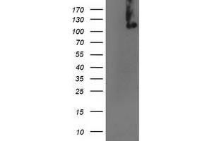 HEK293T cells were transfected with the pCMV6-ENTRY control (Left lane) or pCMV6-ENTRY ERCC4 (Right lane) cDNA for 48 hrs and lysed. (ERCC4 antibody)