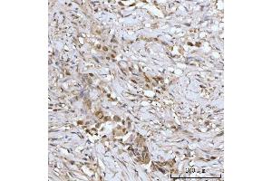 IHC analysis of PRMT5 using anti-PRMT5 antibody (ABIN7600176).