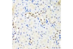 Immunohistochemistry (IHC) image for anti-DEAD (Asp-Glu-Ala-Asp) Box Polypeptide 39A (DDX39) (AA 178-427) antibody (ABIN6139489)