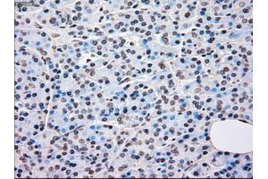 Immunohistochemical staining of paraffin-embedded Kidney tissue using anti-BRAFmouse monoclonal antibody. (BRAF antibody)