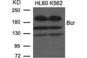 Western blot analysis of extracts from HL60 and K562 cells using Bcr(Ab-177) Antibody. (BCR antibody)