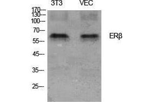 Western Blot (WB) analysis of specific cells using ERbeta Polyclonal Antibody. (ESR2 antibody  (Ser367))