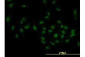 Image no. 3 for anti-Target of EGR1, Member 1 (Nuclear) (TOE1) (AA 1-511) antibody (ABIN599319) (TOE1 antibody  (AA 1-511))