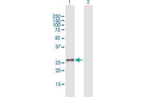 Western Blot analysis of C11orf17 expression in transfected 293T cell line by C11orf17 MaxPab polyclonal antibody. (AKIP1 antibody  (AA 1-210))