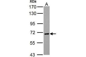 WB Image PCK2 antibody [C1C2], Internal detects PCK2 protein by Western blot analysis. (PEPCK antibody)