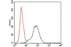 Immunohistochemical analysis of paraffin-embedded bladder cancer tissues using Insulin Like Growth Factor 2 (IGF2) antibody with DAB staining. (IGF2 antibody  (AA 25-180))