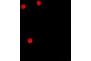 Immunofluorescent analysis of AEBP2 staining in A549 cells. (AEBP2 antibody)