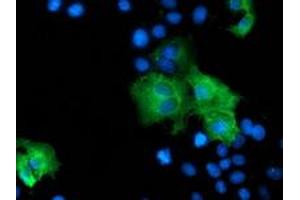 Anti-ZFP36 mouse monoclonal antibody (ABIN2454212) immunofluorescent staining of COS7 cells transiently transfected by pCMV6-ENTRY ZFP36 (RC202049). (ZFP36 antibody)