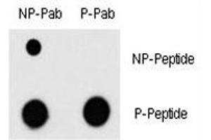 Dot Blot (DB) image for anti-Myocyte Enhancer Factor 2C (MEF2C) (pThr300) antibody (ABIN3031909)
