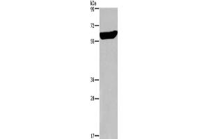 Gel: 6 % SDS-PAGE,Lysate: 40 μg,Primary antibody: ABIN7190535(EGR4 Antibody) at dilution 1/300 dilution,Secondary antibody: Goat anti rabbit IgG at 1/8000 dilution,Exposure time: 30 seconds (EGR4 antibody)