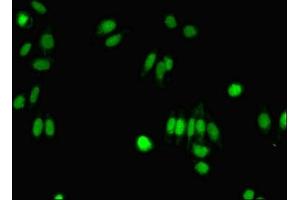 Immunofluorescent analysis of HepG2 cells using ABIN7143007 at dilution of 1:100 and Alexa Fluor 488-congugated AffiniPure Goat Anti-Rabbit IgG(H+L) (FIBP antibody  (AA 2-357))