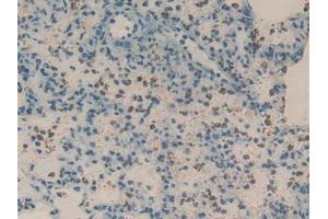Detection of REG3g in Rat Lung Tissue using Polyclonal Antibody to Regenerating Islet Derived Protein 3 Gamma (REG3g)