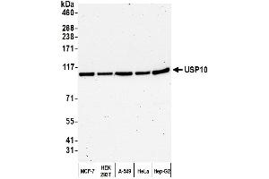 Western Blotting (WB) image for anti-Ubiquitin Specific Peptidase 10 (USP10) (AA 50-100) antibody (ABIN7453890) (USP10 antibody  (AA 50-100))