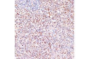 Immunohistochemistry (IHC) image for anti-Mitochondrial Ribosomal Protein L46 (MRPL46) (AA 1-279) antibody (ABIN7268574)
