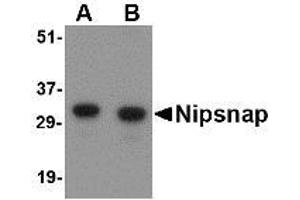 Image no. 1 for anti-4-Nitrophenylphosphatase Domain and Non-Neuronal SNAP25-Like Protein Homolog 1 (NIPSNAP1) (Internal Region) antibody (ABIN1493790) (NIPSNAP1 antibody  (Internal Region))