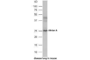 Mouse lung lysate probed with Rabbit Anti-Melan A Polyclonal Antibody, Unconjugated (ABIN2559583) at 1:300 in 4˚C. (MLANA antibody  (AA 1-80))
