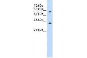 WB Suggested Anti-SLC22A1 Antibody Titration:  5. (SLC22A1 antibody  (C-Term))