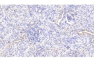 Detection of NUTF2 in Human Kidney Tissue using Polyclonal Antibody to Nuclear Transport Factor 2 (NUTF2) (NUTF2 antibody  (AA 1-127))