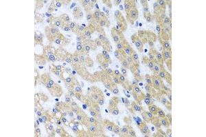Immunohistochemistry of paraffin-embedded human liver injury using PRMT2 antibody (ABIN5973447) at dilution of 1/100 (40x lens). (PRMT2 antibody)