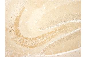 Immunohistochemistry (IHC) image for anti-CREB Regulated Transcription Coactivator 1 (CRTC1) (C-Term) antibody (ABIN7448839) (CRTC1 antibody  (C-Term))