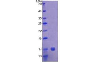 SDS-PAGE analysis of Human CAP1 Protein. (CAP1 Protein)