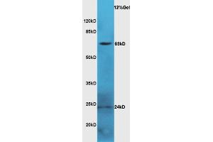 LGALS3BP antibody  (AA 301-400)