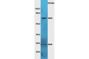 Mouse serum lysate probed with Anti LGALS3BP Polyclonal Antibody, Unconjugated  at 1:3000 for 90 min at 37˚C.