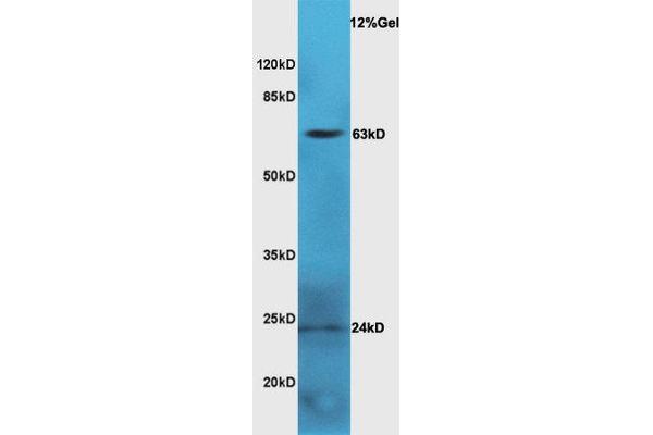 LGALS3BP 抗体  (AA 301-400)
