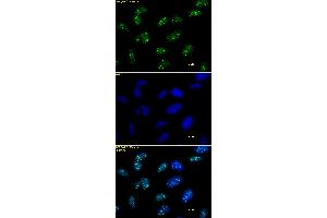 Histone H3 trimethyl Lys9 antibody tested by immunofluorescence. (Histone 3 antibody  (3meLys9))