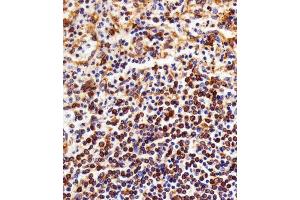 Immunohistochemical analysis of paraffin-embedded H. (NFKB1 antibody)