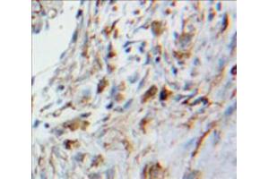 Used in DAB staining on fromalin fixed paraffin-embedded Lung tissue (HMOX2 antibody  (AA 41-292))