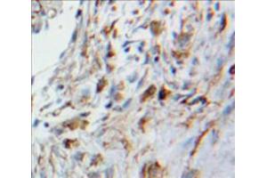 Used in DAB staining on fromalin fixed paraffin-embedded Lung tissue (HMOX2 antibody  (AA 41-292))