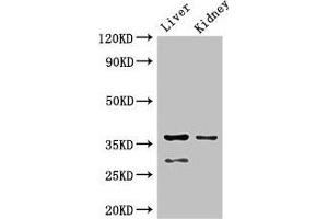 Western Blot Positive WB detected in: Mouse liver tissue, Mouse kidney tissue All lanes: PPP2CA antibody at 2. (PPP2CA antibody  (Catalytic Subunit alpha))