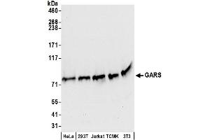 Western Blotting (WB) image for anti-Glycyl-tRNA Synthetase (GARS) (AA 689-739) antibody (ABIN7450272)